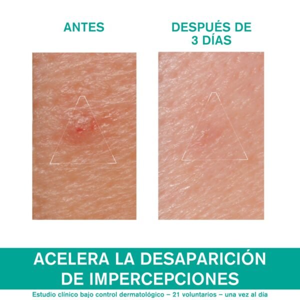 Hyseac Pate Sos Para Brotes 15G - Image 3